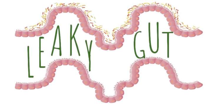 Leaky Gut What Is It | El Paso Texas Chiropractor