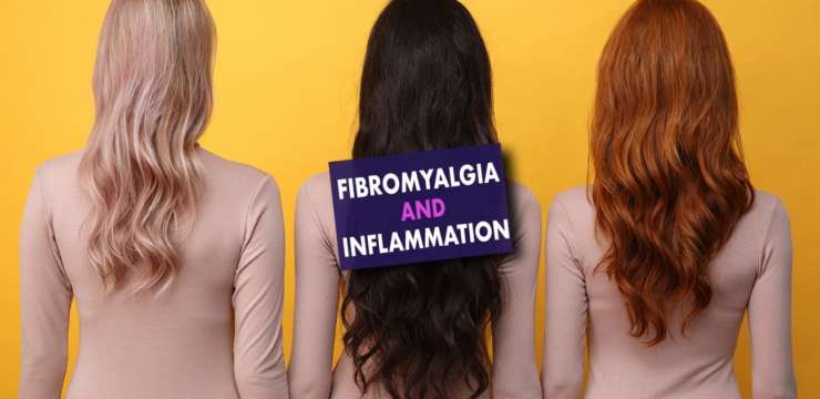 Fibromyalgia