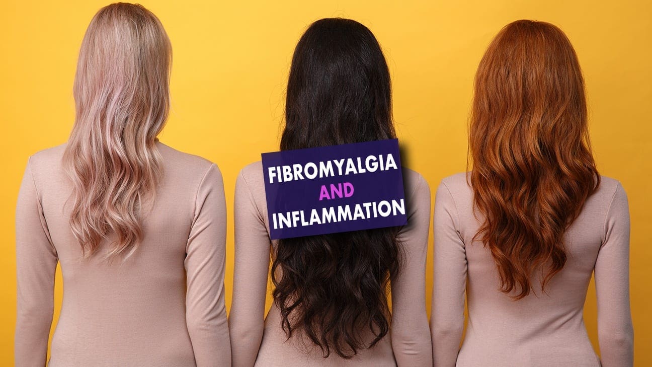 Fibromyalgia