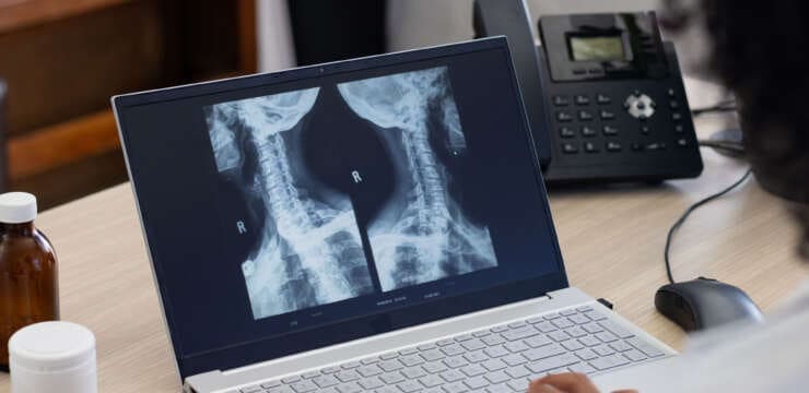 Enhanced Surgical Recovery Programs Improve Healing