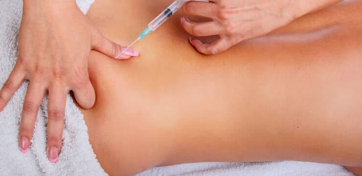 PRP for Sciatica: How It May Help You