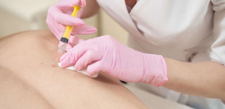 PRP Therapy for Spine Pain Relief and Healing