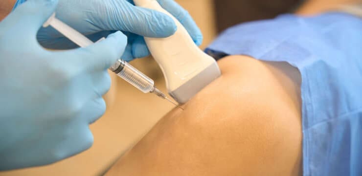 Platelet-Rich Plasma Therapy and Sports Injuries Solutions