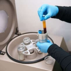 PRP and Chiropractic for Musculoskeletal Healing Benefits
