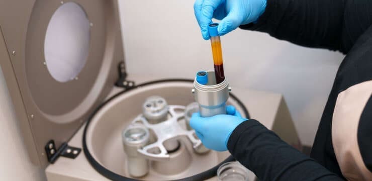 PRP and Chiropractic for Musculoskeletal Healing Benefits