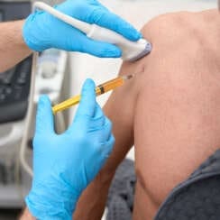 Ultrasound-Guided PRP for Shoulder and Knee Injuries Explained