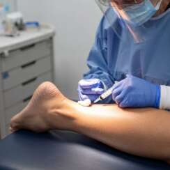 Plantar Fasciitis Results With PRP Therapy on the Achilles Tendon